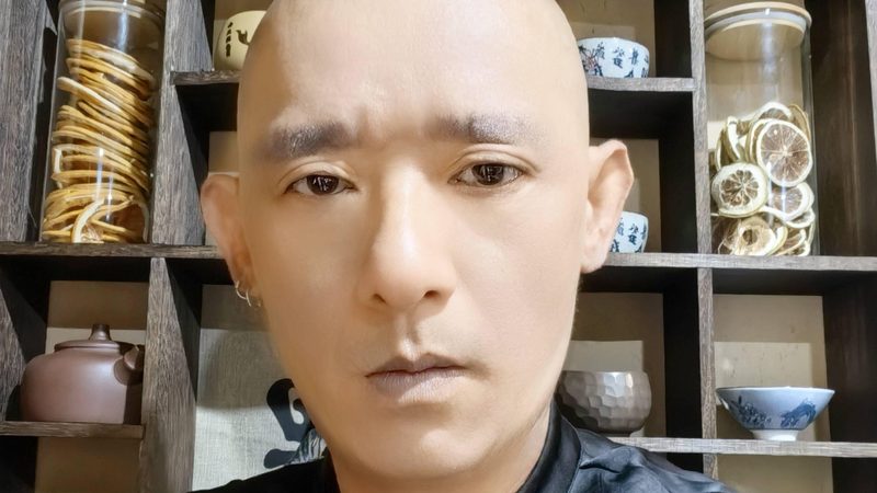 针灸减肥：一个疗程，揭秘背后的秘密与成本